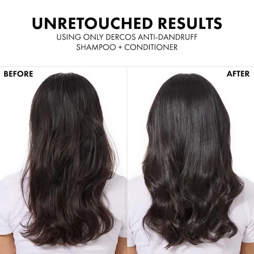 Vista 7 de Dercos Dandruff Shampoo, Antifungal Dry Scalp Treatment & Itchy Scalp Relief, Prescription Strength Selenium Sulfide Comparable to 2% Ketoconazole