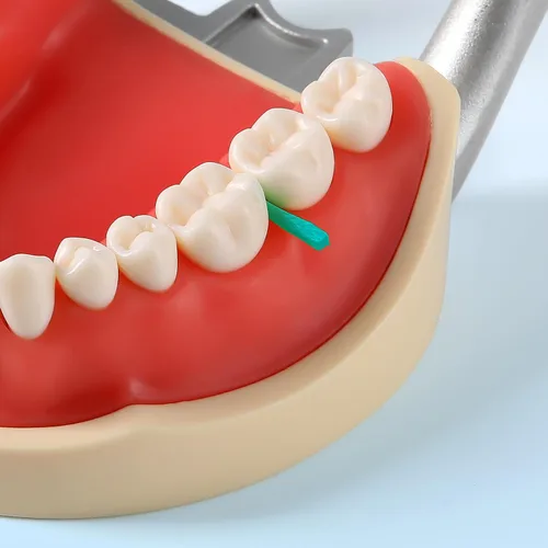 Vista 3 de JMU Cuñas Dentales de Madera, Cuñas Desechables de Madera 1.5x2x14mm, Verdes, 100 Piezas